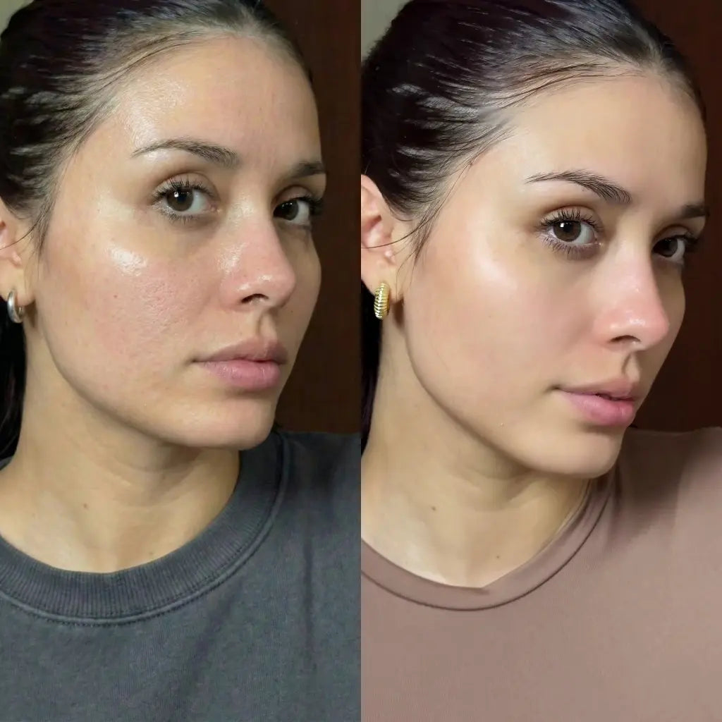 LumeaGlow Peel Shot