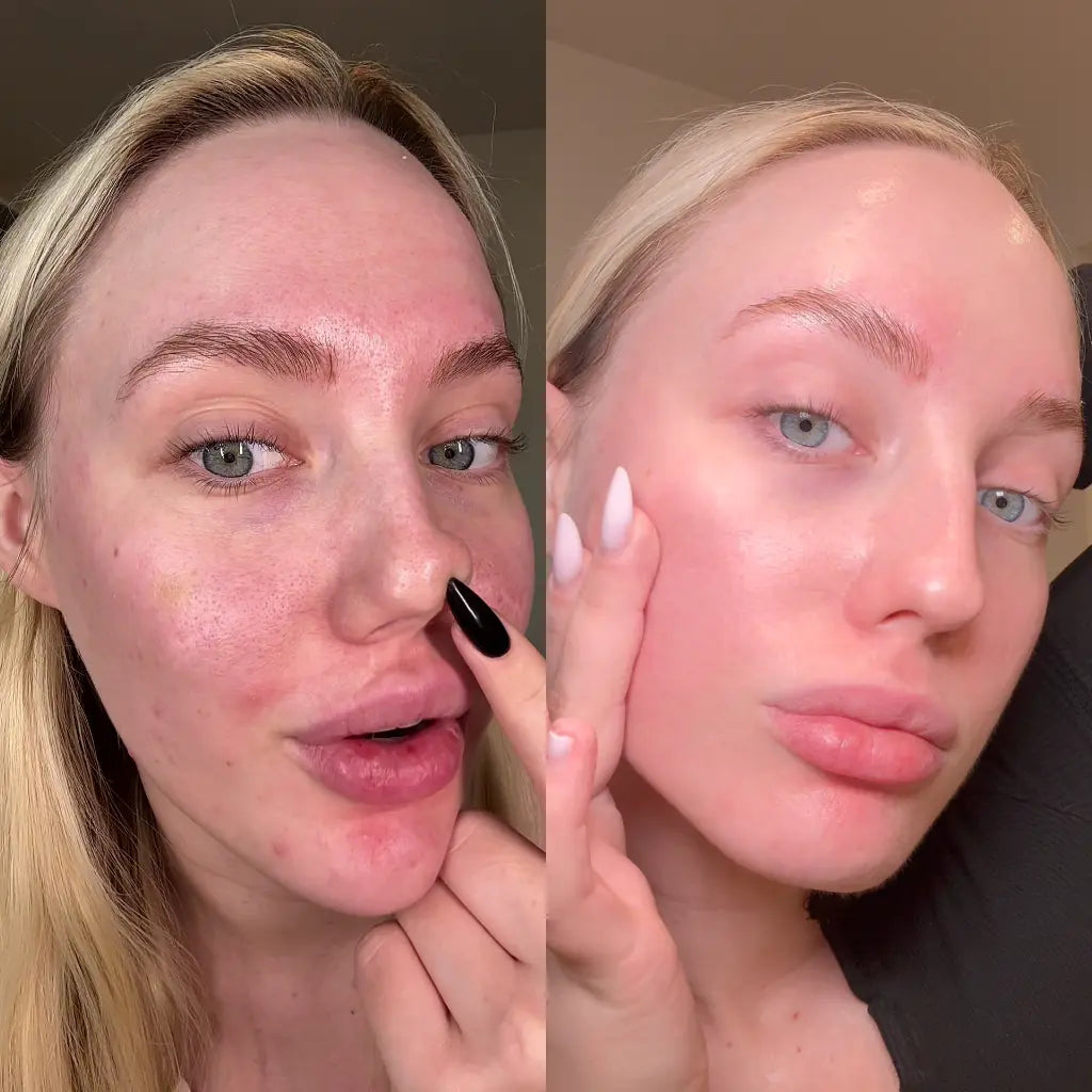 LumeaGlow Peel Shot